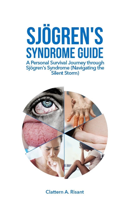 Sjögren's Syndrome Guide: A Personal Survival Journey through Sjögren's Syndrome (Navigating the Silent Storm)