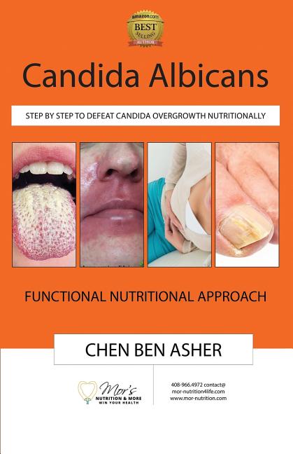 Candida Albicans: Step by Step to Defeat Candida Overgrowth Nutritionally