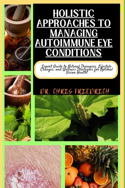 Holistic Approaches to Managing Autoimmune Eye Conditions: Expert Guide to Natural Therapies, Lifestyle Changes, and Wellness Strategies for Optimal V