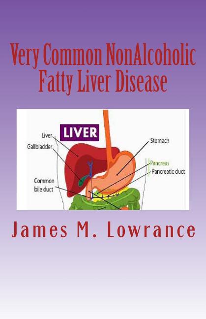 Very Common NonAlcoholic Fatty Liver Disease: How To Know if You Have Hepatic Steatosis