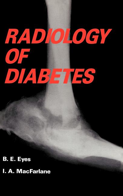 Radiology of Diabetes (1986)