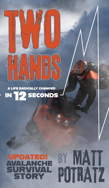 Two Hands: A Life Radically Changed In 12 Seconds